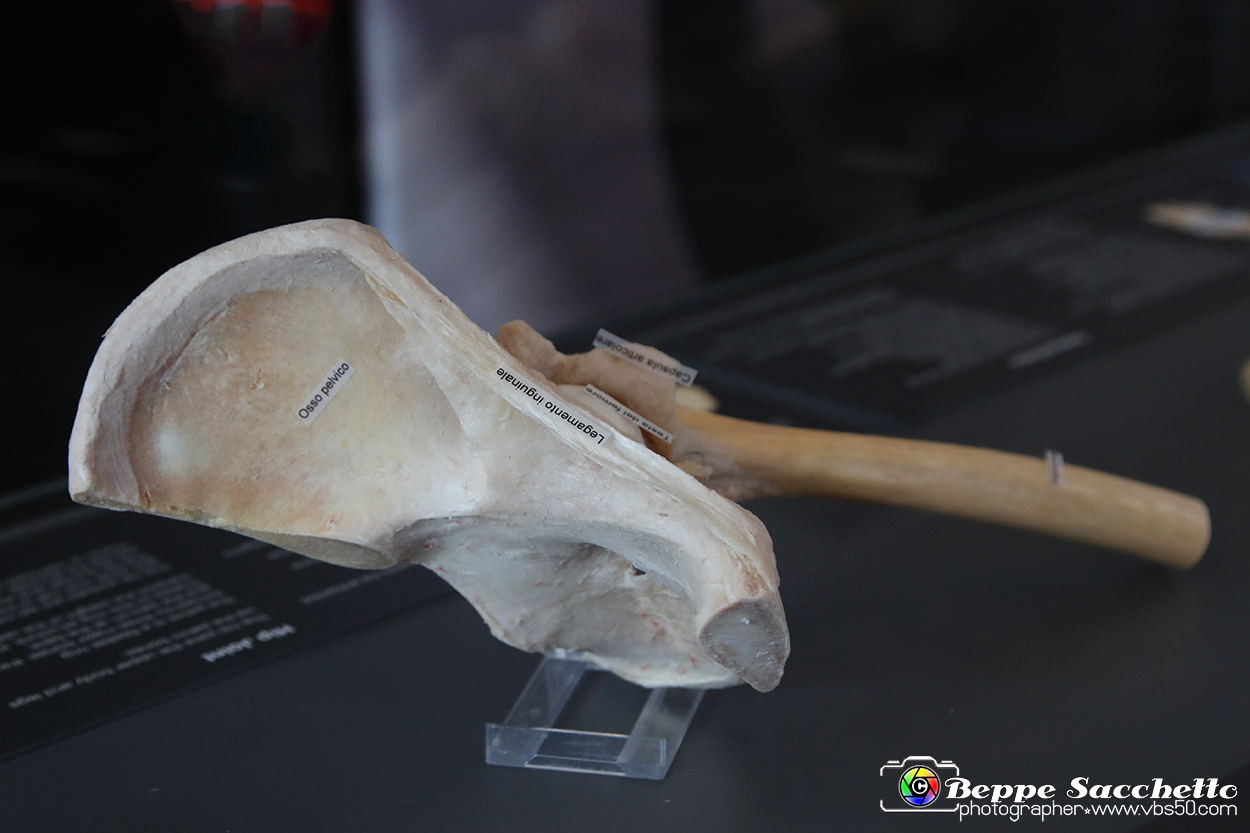 VBS_3064 - Articolazione dell'anca - Mostra Body Worlds.jpg